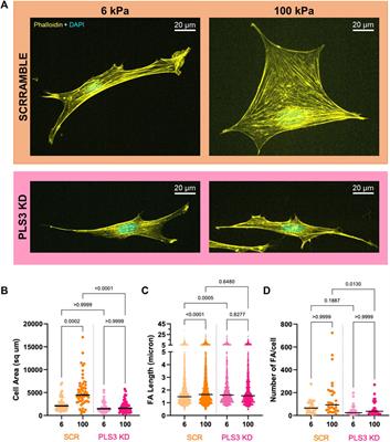 The actin-bundling protein, PLS3, is part of the mechanoresponsive machinery that regulates osteoblast mineralization